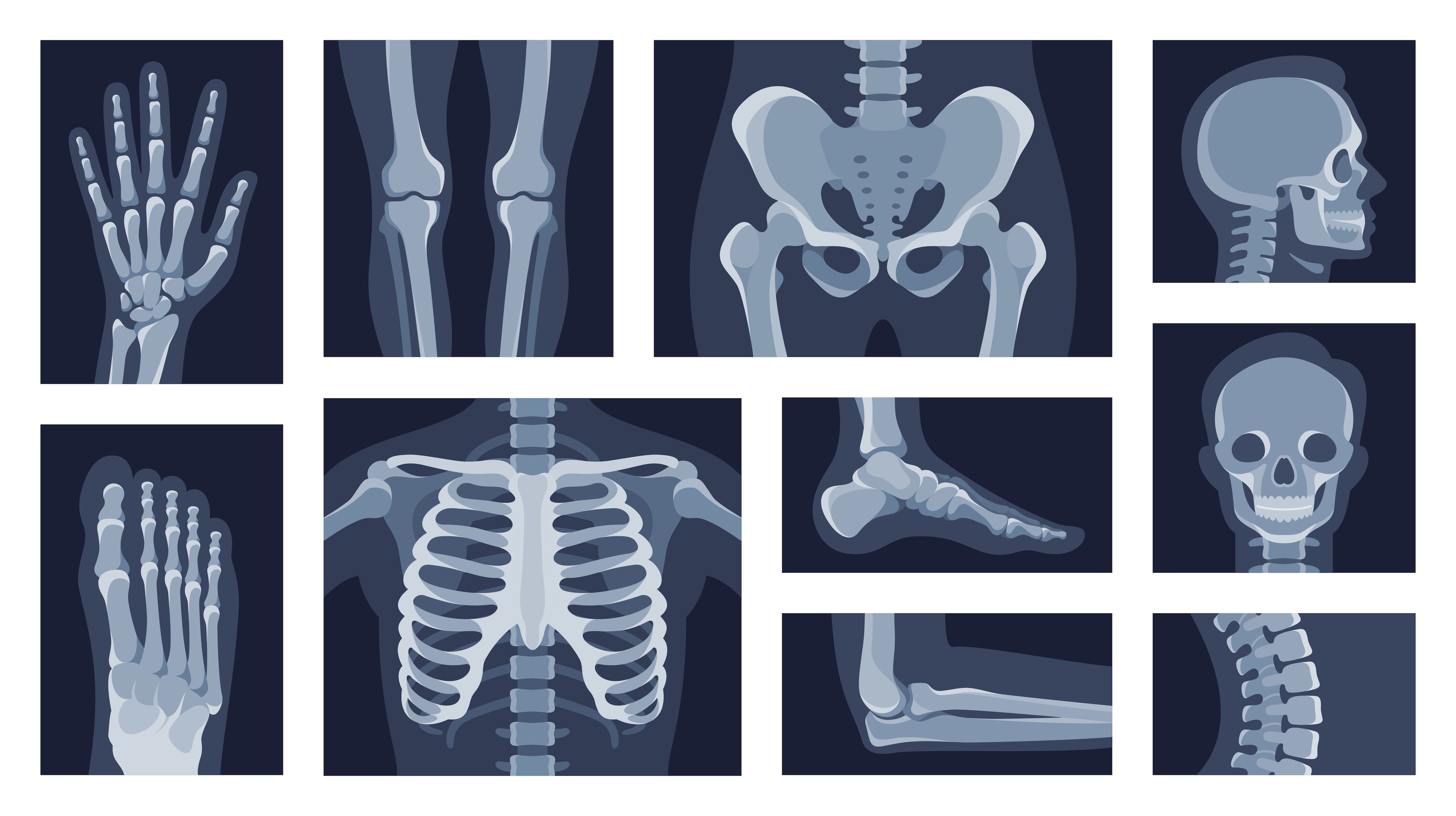 Generic illustrations of various body parts via xray. 